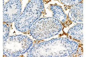 ABIN6265772 and ABIN6273336 at 1/100 staining Mouse testis tissue by IHC-P. (TSH receptor Antikörper  (Internal Region))