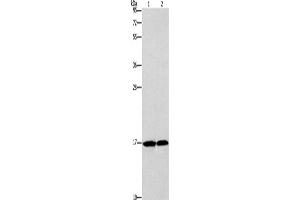Western Blotting (WB) image for anti-Glia Maturation Factor, gamma (GMFG) antibody (ABIN2422817) (GMFG Antikörper)