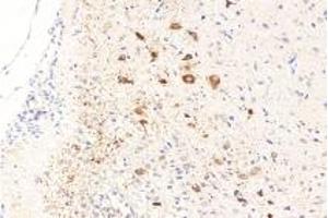 Immunohistochemistry analysis of paraffin-embedded rat brain using RASGRP3 (ABIN7075376) at dilution of 1: 1000 (RASGRP3 Antikörper)