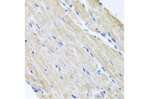 Immunohistochemistry of paraffin-embedded mouse heart using ABCB8 antibody. (ABCB8 Antikörper)