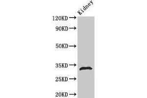 Western Blot Positive WB detected in: Rat kidney tissue All lanes: HIST1H1B antibody at 1 μg/mL Secondary Goat polyclonal to rabbit IgG at 1/50000 dilution Predicted band size: 23 kDa Observed band size: 32 kDa (Histone H1.5 Antikörper  (pSer188))