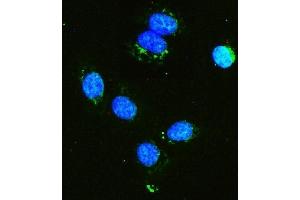 IF analysis of Hexokinase 1/HK1 using anti-Hexokinase 1/HK1 antibody (ABIN7600259). (Hexokinase 1 Antikörper  (AA 17-323))