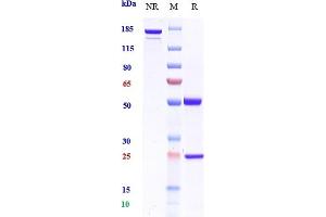Anti-CSF2 / GM-CSF Reference Antibody (namilumab) on SDS-PAGE under reducing (R) condition. (Rekombinanter CSF2 (Namilumab Biosimilar) Antikörper)