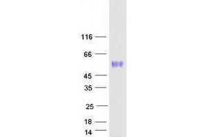 Western Blotting (WB) image for Oncostatin M Receptor (OSMR) (Transcript Variant 2) protein (Myc-DYKDDDDK Tag) (ABIN2728004)