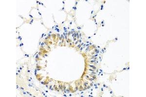 Immunohistochemistry of paraffin-embedded Mouse lung using COQ7 Polyclonal Antibody at dilution of 1:100 (40x lens). (Coq7 Antikörper)