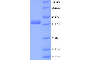 SDS-PAGE (SDS) image for Annexin A5 (ANXA5) (AA 2-320) protein (His tag) (ABIN5713230)