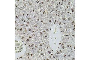 Immunohistochemistry (Paraffin-embedded Sections) (IHC (p)) image for anti-Histone Cluster 1, H2ag (HIST1H2AG) antibody (ABIN3068853)
