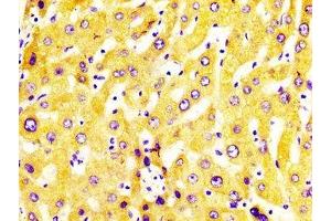 IHC image of ABIN7149243 diluted at 1:400 and staining in paraffin-embedded human liver tissue performed on a Leica BondTM system. (CYP2C19 Antikörper  (AA 245-353))
