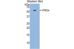 Western Blotting (WB) image for anti-Heat Shock 70kDa Protein 14 (HSPA14) (AA 1-509) antibody (ABIN1859210) (HSPA14 Antikörper  (AA 1-509))