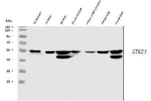 Western blot analysis of MST3/STK24 using anti-MST3/STK24 antibody (ABIN7599389). (STK24 Antikörper  (AA 1-433))