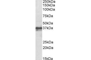 ABIN625827 (1µg/ml) staining of Mouse Skin lysate (35µg protein in RIPA buffer).