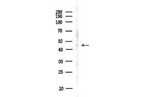 Western blot analysis of lysates from MDA-MB-231 cells(heat-shock,45 min treatment), using LIS1 Antibody at 1/1000 dilution.