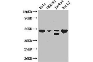 Western Blot Positive WB detected in: Hela whole cell lysate, HEK293 whole cell lysate, Jurkat whole cell lysate, HepG2 whole cell lysate All lanes: PLIN3 antibody at 3 μg/mL Secondary Goat polyclonal to rabbit IgG at 1/50000 dilution Predicted band size: 48, 29, 47, 46 kDa Observed band size: 48, 46 kDa (PLIN3 Antikörper  (AA 192-324))