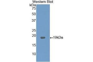 Western Blotting (WB) image for anti-Lysophosphatidylcholine Acyltransferase 3 (LPCAT3) (AA 122-233) antibody (ABIN1176546) (LPCAT3 Antikörper  (AA 122-233))