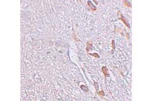 Immunohistochemistry (IHC) image for anti-Leucine Rich Repeat Transmembrane Neuronal 1 (LRRTM1) (C-Term) antibody (ABIN1030496) (LRRTM1 Antikörper  (C-Term))