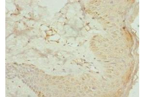 Immunohistochemistry of paraffin-embedded human skin tissue using ABIN7142022 at dilution of 1:100 (AGPAT2 Antikörper  (AA 199-278))