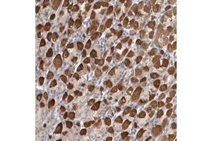 Immunohistochemical staining of human stomach with SRD5A3 polyclonal antibody  shows strong cytoplasmic positivity in subset of glandular cells. (SRD5A3 Antikörper)
