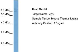 Host:  Rabbit  Target Name:  Zfy2  Sample Type:  Mouse Thymus lysates  Antibody Dilution:  1.