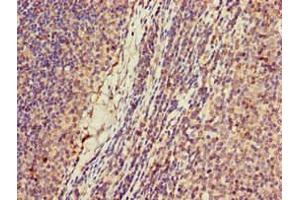 Immunohistochemistry of paraffin-embedded human lymph node tissue using ABIN7157644 at dilution of 1:100 (KIF2A Antikörper  (AA 5-308))