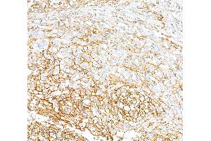 Immunohistochemistry (IHC) image for anti-CD44 (CD44) (AA 700-742) antibody (ABIN7454002) (Rekombinanter CD44 Antikörper  (AA 700-742))