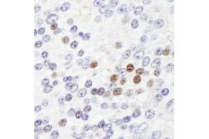 Immunohistochemistry (IHC) image for anti-Zinc Fingers and Homeoboxes 3 (ZHX3) (AA 150-200) antibody (ABIN7449040) (ZHX3 Antikörper  (AA 150-200))