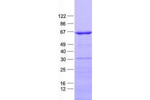 Validation with Western Blot (KLF10/TIEG1 Protein (His tag))
