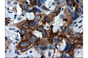 Image no. 2 for anti-Keratin 18 (KRT18) (AA 69-372) antibody (ABIN1491637) (Cytokeratin 18 Antikörper  (AA 69-372))