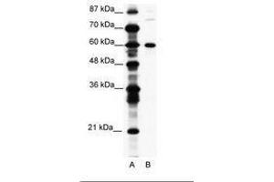 Image no. 1 for anti-CCR4-NOT Transcription Complex, Subunit 3 (CNOT3) (AA 141-190) antibody (ABIN203225) (CNOT3 Antikörper  (AA 141-190))