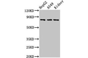 Western Blot Positive WB detected in: HepG2 whole cell lysate, A549 whole cell lysate, Rat kidney tissue All lanes: UIMC1 antibody at 3 μg/mL Secondary Goat polyclonal to rabbit IgG at 1/50000 dilution Predicted band size: 80, 62, 71, 39, 18 kDa Observed band size: 80 kDa (UIMC1 Antikörper  (AA 161-235))