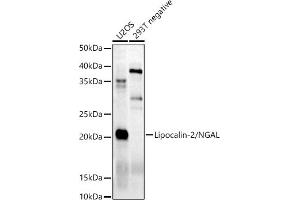 Western blot analysis of extracts of various cell lines, using Lipocalin-2/NGAL antibody (ABIN6128177, ABIN6143114, ABIN6143115 and ABIN6215076) at 1:500 dilution. (Lipocalin 2 Antikörper)