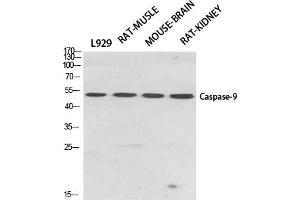 Western Blotting (WB) image for anti-Caspase 9, Apoptosis-Related Cysteine Peptidase (CASP9) (Thr125) antibody (ABIN5960804) (Caspase 9 Antikörper  (Thr125))