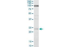 ATG5 monoclonal antibody (M05), clone 1E7. (ATG5 Antikörper  (AA 176-275))