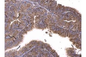 IHC-P Image GNAQ antibody detects GNAQ protein at cytosol on mouse prostate by immunohistochemical analysis.