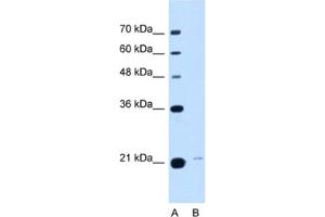 Western Blotting (WB) image for anti-Transmembrane Emp24 Protein Transport Domain Containing 3 (TMED3) antibody (ABIN2463022) (TMED3 Antikörper)