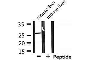 Western Blotting (WB) image for anti-DNA-Damage-Inducible Transcript 3 (DDIT3) (N-Term) antibody (ABIN6261867)
