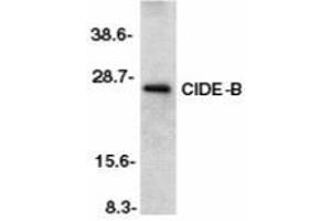Western blot analysis of CIDE-B in mouse liver tissue lysate with AP30231PU-N CIDE-B antibody at 1/500 dilution. (CIDEB Antikörper  (C-Term))