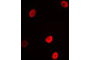 Immunofluorescent analysis of L3MBTL3 staining in MCF7 cells.