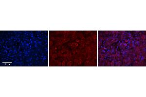 Rabbit Anti-GGCX Antibody      Formalin Fixed Paraffin Embedded Tissue: Human Adult Liver   Observed Staining: Cytoplasm in hepatocytes, strong signal, wide tissue distribution  Primary Antibody Concentration: 1:100  Secondary Antibody: Donkey anti-Rabbit-Cy3  Secondary Antibody Concentration: 1:200  Magnification: 20X  Exposure Time: 0. (GGCX Antikörper  (Middle Region))