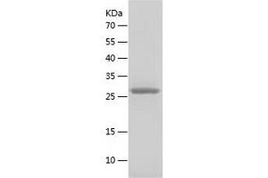Western Blotting (WB) image for Fibrillarin (FBL) (AA 83-321) protein (His tag) (ABIN7122909) (Fibrillarin Protein (FBL) (AA 83-321) (His tag))