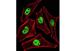 Fluorescent ige of Hela cells stained with SRCD3 Antibody (N-term) (ABIN6242643 and ABIN6577395). (SMARCD3 Antikörper  (N-Term))