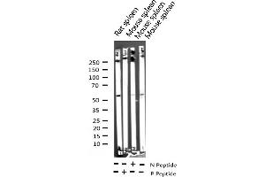 Western blot analysis of Phospho-Lck (Tyr393) expression in various lysates (LCK Antikörper  (pTyr393))