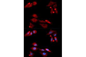 Immunofluorescence analysis of U2OS cells using GFRA1 antibody (ABIN5973109). (GFRA1 Antikörper)