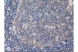 Image no. 8 for anti-Striatin Interacting Protein 1 (STRIP1) antibody (ABIN1498205) (STRIP1 Antikörper)