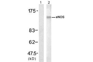 Western blot analysis of extract from H (ENOS Antikörper)