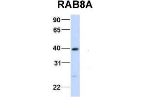 Host:  Rabbit  Target Name:  RAB8A  Sample Type:  Human Fetal Liver  Antibody Dilution:  1. (RAB8A Antikörper  (Middle Region))