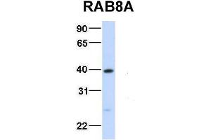 Host:  Rabbit  Target Name:  RAB8A  Sample Type:  Human Fetal Liver  Antibody Dilution:  1.
