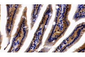 Immunohistochemistry (IHC) image for anti-Fatty Acid Binding Protein 1, Liver (FABP1) (AA 2-127) antibody (ABIN7433792)
