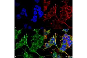 Immunocytochemistry/Immunofluorescence analysis using Mouse Anti-GluN2A/NR2A Monoclonal Antibody, Clone S327-95 . (NMDAR2A Antikörper  (AA 75-325) (APC))
