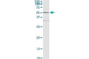 ACY1 (Human) IP-WB Antibody Pair