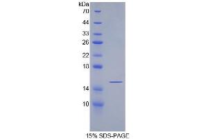 SDS-PAGE analysis of Rat SFRP5 Protein. (SFRP5 Protein)
